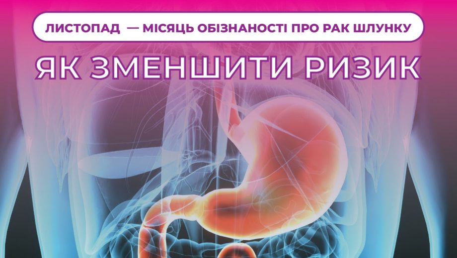 Як зменшити ймовірність раку шлунку: вісім порад