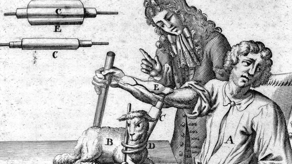 Дещо з міжвидової трансплантації органів